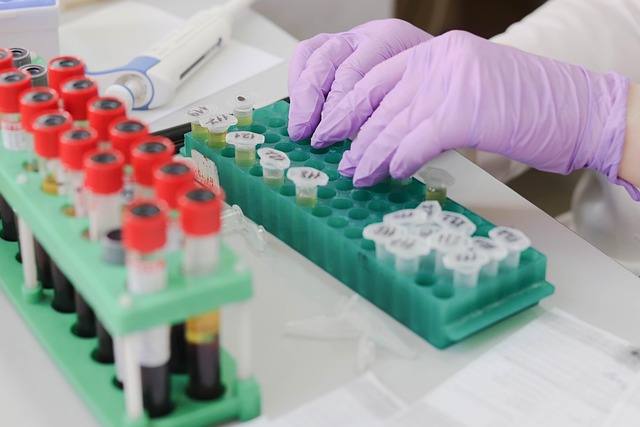 Find Lab Work In Toledo