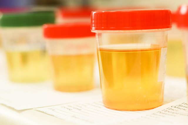 Find Lab Work In Columbus