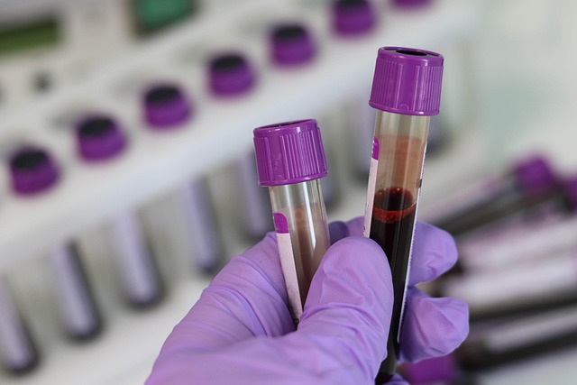 Find Lab Work In Detroit-livonia-dearborn